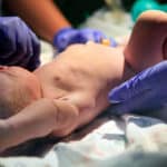 baby being assessed in newborn exam at hospital