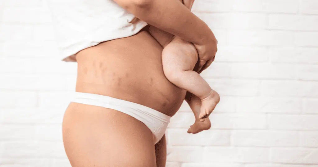 New mom holds baby showing her postpartum belly