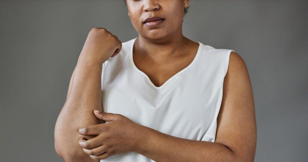 woman itching arm due to cholestasis in pregnancy