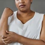woman itching arm due to cholestasis in pregnancy