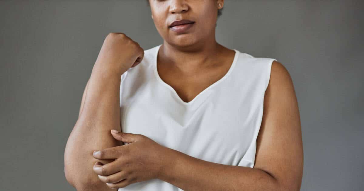 woman itching arm due to cholestasis in pregnancy