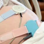 fetal monitoring on a pregnant mom belly