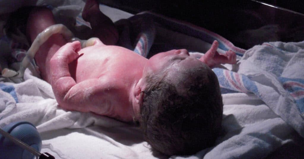 newborn baby at hospital with cord attached and vernix