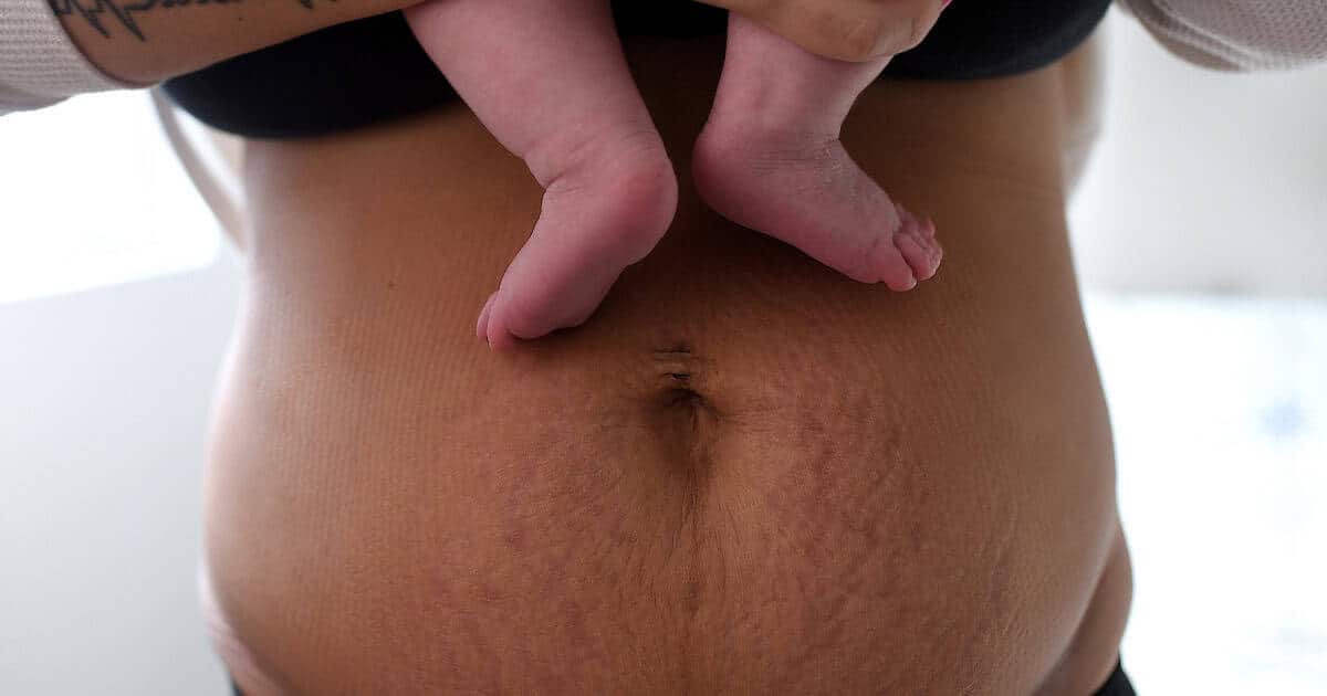 postpartum mom's belly with baby feet