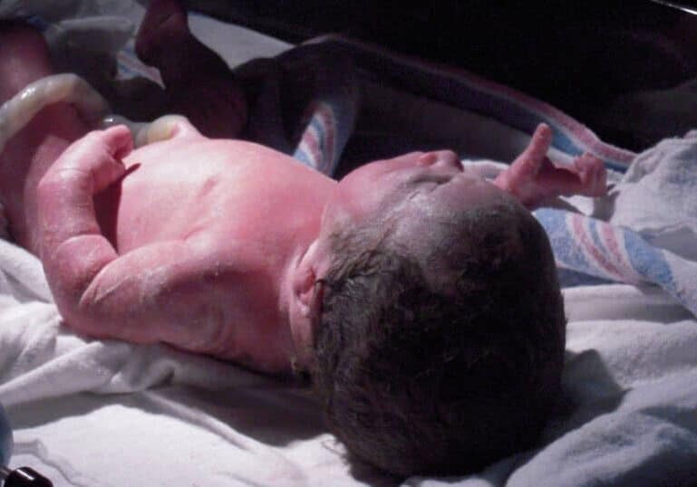 newborn baby at hospital with cord attached and vernix