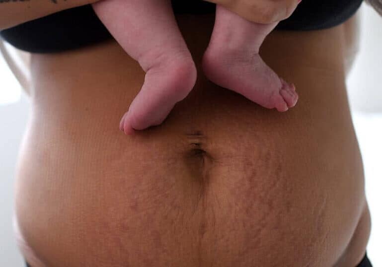 postpartum mom's belly with baby feet