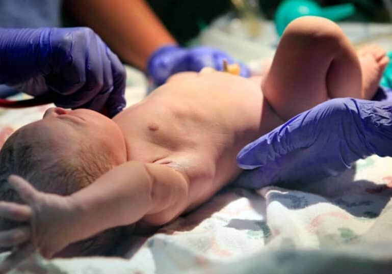 baby being assessed in newborn exam at hospital