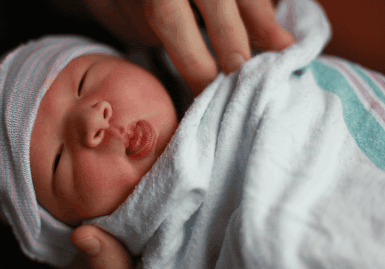assessing newborn baby for tongue tie